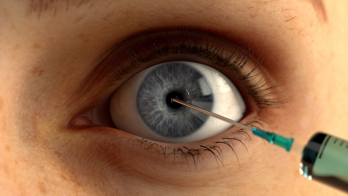Graphic Moisten of the cornea