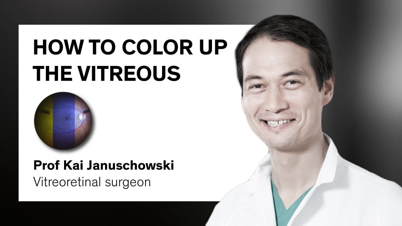 OS 4: All in one experience | Benefit of the color adjustable light source | Kai Januschowski | #002