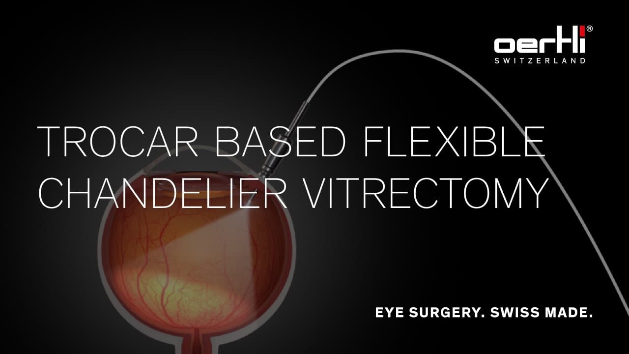 Trocar Based Flexible Chandelier Vitrectomy | Intraocular Illumination | Vitreoretinal Surgery