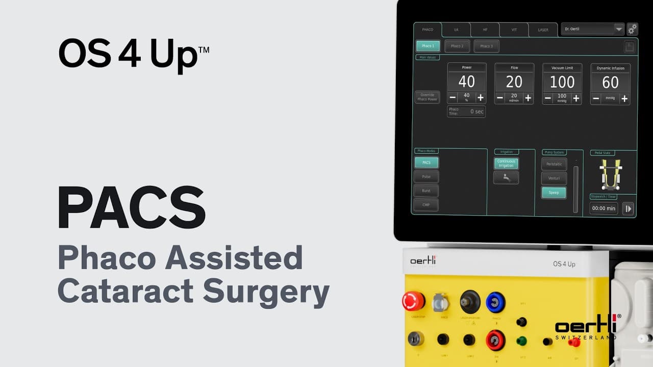 PACS powered by the OS 4 Up | Phaco Assisted Cataract Surgery
