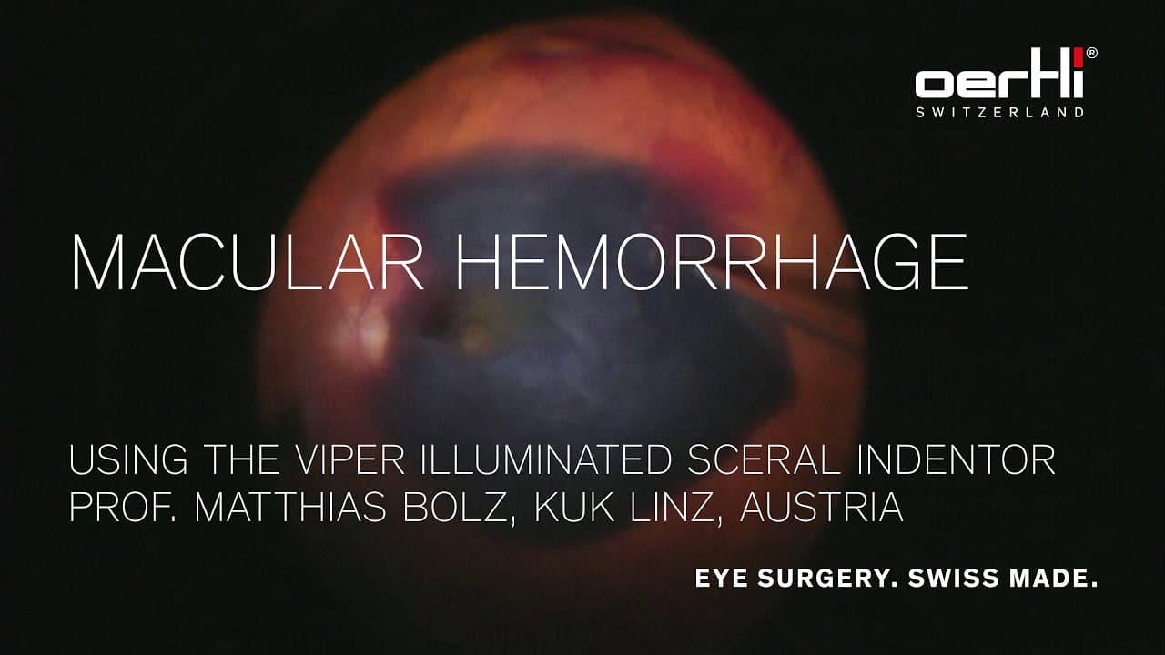 ViPer: Macular Hemorrhage by Matthias Bolz