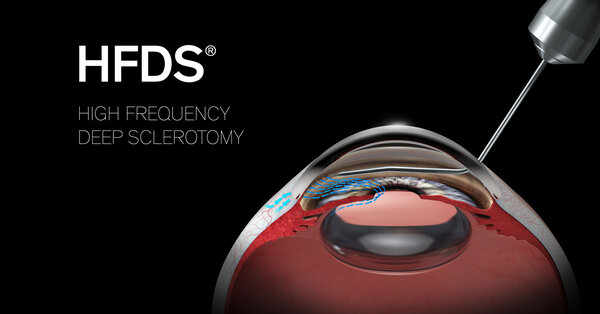 Graphic High Frequency Deep Sclerotomy (HFDS)
