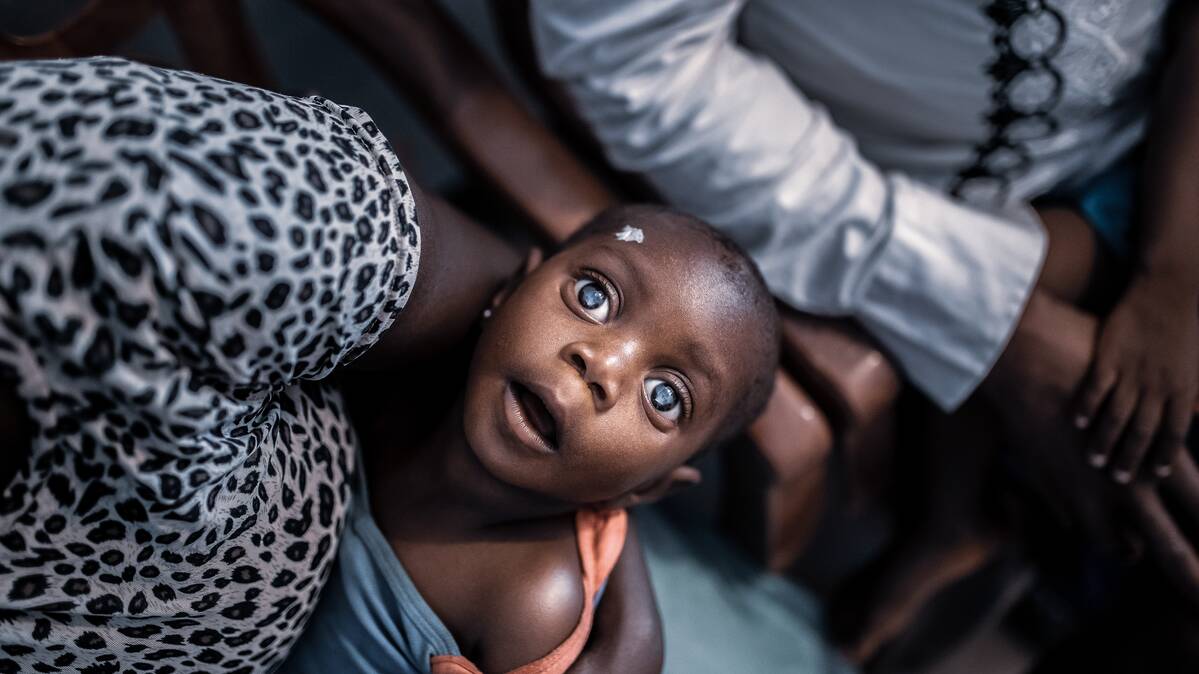 “A portrait of a child with double cataract, who is waiting for eye surgery” by Andra D. Hajdu / OWW and Foundation of Doctor Richard for Congolese Patients / Richard Testver Kongoi Betegekert Alapitvany This picture is licensed under CC BY-NC-SA 4.0